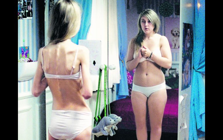 Miles de jóvenes caen presas de estos dos padecimientos: anorexia y bulimia. ESPECIAL  /