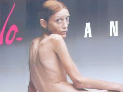 La modelo francesa posó en 2007 desnuda en una campaña publicitaria para alertar a las mujeres sobre esta enfermedad. AFP  /