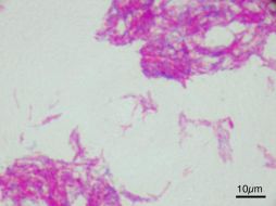 Imagen microscópica de la vacuna BCG. EFE  /