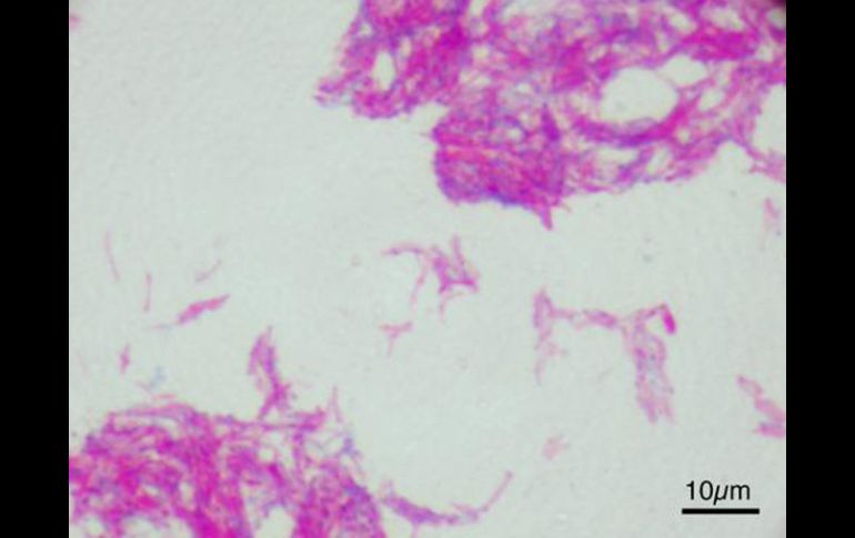 Imagen microscópica de la vacuna BCG. EFE  /