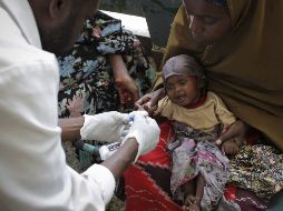 Un bebé recibe asistencia médica en el hospital de Banadir en Mogadiscio, Somalia. EFE  /