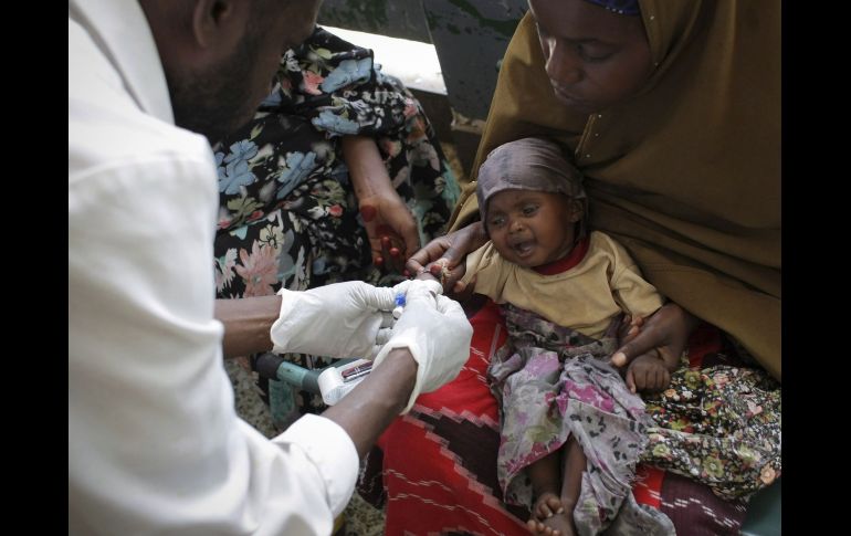 Un bebé recibe asistencia médica en el hospital de Banadir en Mogadiscio, Somalia. EFE  /