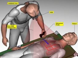 Con este avance se pretende conseguir que astronautas puedan solucionar problemas médicos por su cuenta. ESPECIAL  /