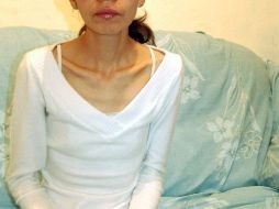 La moda puede ser mortal. En la foto: mujer que pesa 28 kgs. a causa de la anorexia. ARCHIVO  /