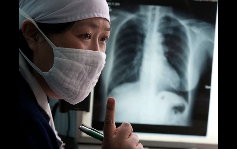 La tuberculosis mata a 1.5 millones de personas en todo el mundo cada año. AP  /