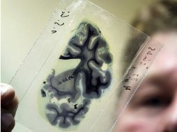 Científicos en Suiza resuelven más misterios del cerebro. ARCHIVO  /