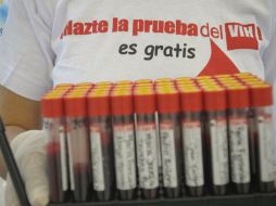 Se han realizando mil 697 pruebas rápidas para la detección del VIH, de forma gratuita. ARCHIVO  /