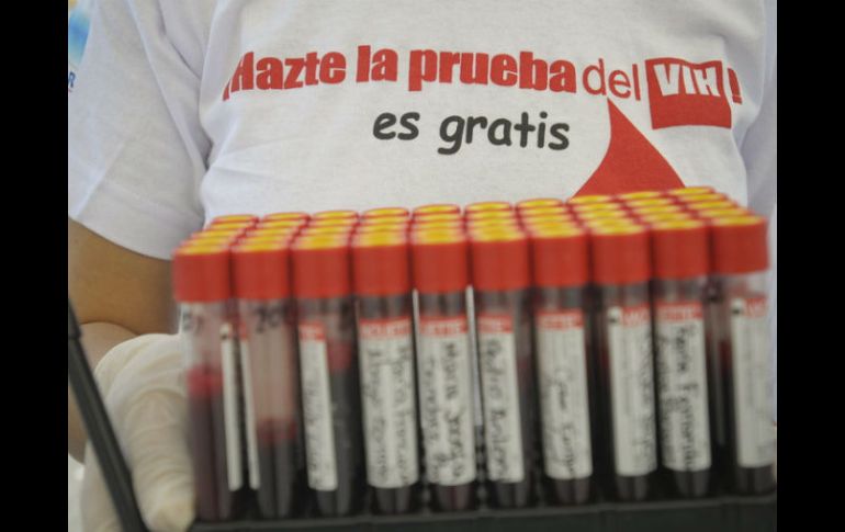 Se han realizando mil 697 pruebas rápidas para la detección del VIH, de forma gratuita. ARCHIVO  /