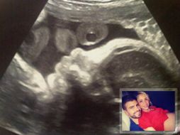 Imagen del ultrasonido del primer hijo de Piqué y Shakira. @3gerardpique  /