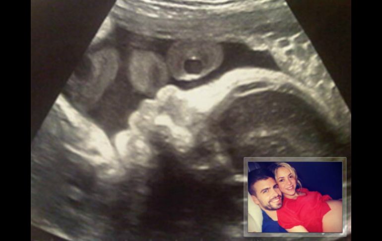 Imagen del ultrasonido del primer hijo de Piqué y Shakira. @3gerardpique  /