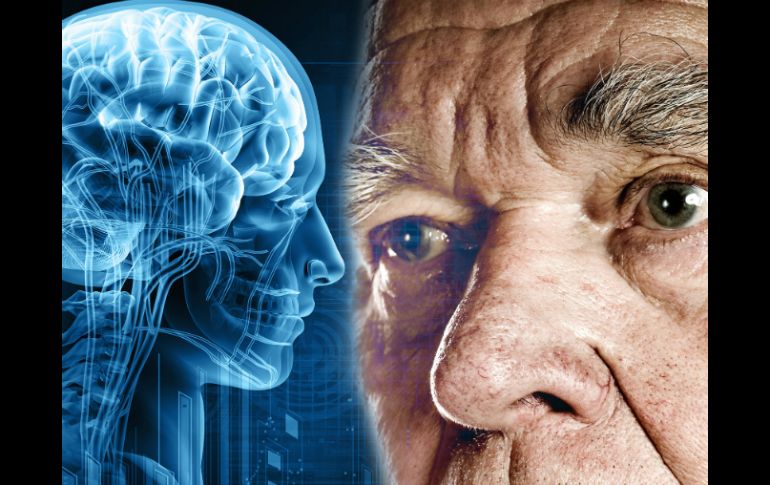 Se estima que hay unos 36 millones de enfermos de alzheimer en el mundo. ID  /