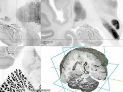 BigBrain es el primer modelo con una representación realista de este órgano con las células de todas las estructuras cerebrales. AP /