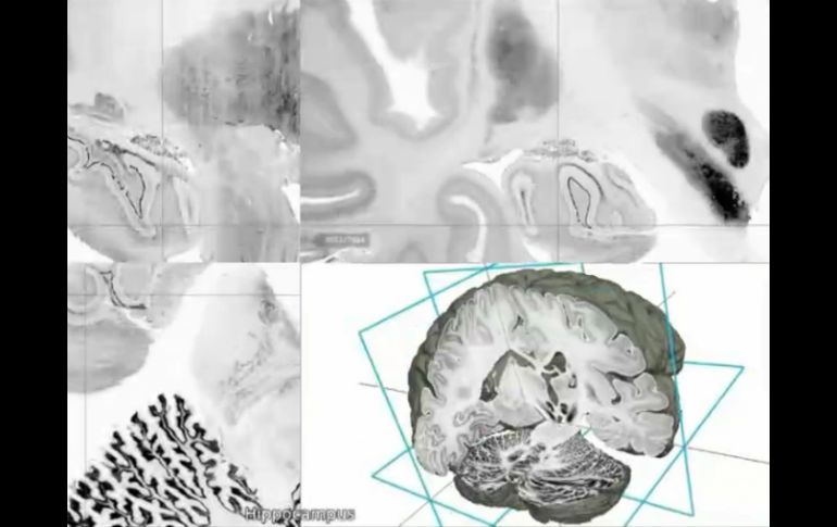 BigBrain es el primer modelo con una representación realista de este órgano con las células de todas las estructuras cerebrales. AP /