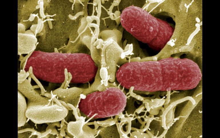 La Escherichia colies un tipo de bacteria que puede crecer y metabolizar tanto en presencia como en ausencia de oxígeno. ARCHIVO /