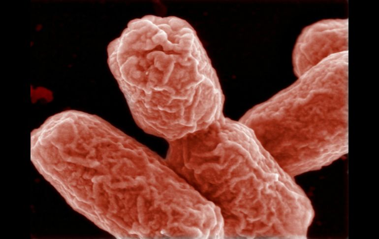 La mitad de las infecciones adquiridas en los hospitales después de una intervención quirúrgica, se deben a las biopelículas. ARCHIVO /