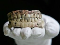 Una caries severa puede generar otras afecciones como artritis reumatoide. ARCHIVO /