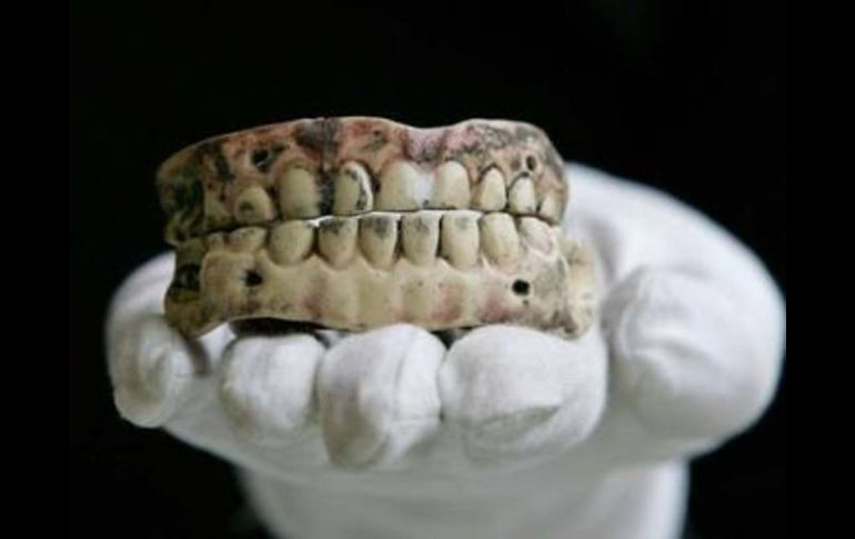 Una caries severa puede generar otras afecciones como artritis reumatoide. ARCHIVO /