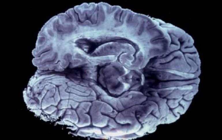 Hasta ahora los doctores estudiaban las imágenes cerebrales ''a simple vista''. ARCHIVO /