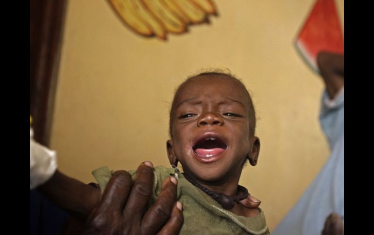 Más de 206 mil niños menores de 5 años padecen malnutrición aguda en el país africano. ARCHIVO /