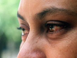 Las personas afectadas presentaron cuadros de conjuntivitis, dermatitis y males gastrointestinales. EL INFORMADOR  ARCHIVO  /