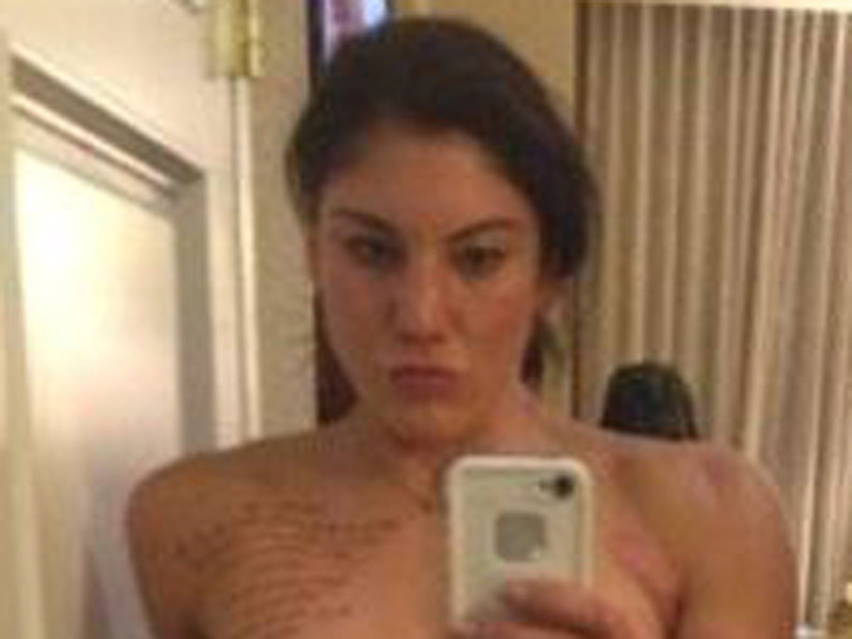 Hope Solo es mostrada al desnudo en fotos | El Informador