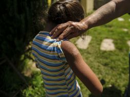 Cuando los pacientes se detectan alguna alteración en la piel creen que es problema dermatológico, pero en realidad es respiratorio. EL INFORMADOR / ARCHIVO