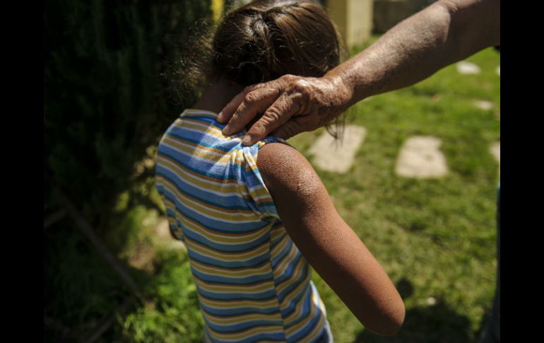 Cuando los pacientes se detectan alguna alteración en la piel creen que es problema dermatológico, pero en realidad es respiratorio. EL INFORMADOR / ARCHIVO