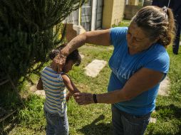 La piel exfoliada puede mostrar una especial sensibilidad al sol durante uno o varios años. EL INFORMADOR / ARCHIVO