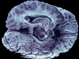 El proceso trata de generar conexiones entre las redes que conforman los 86 mil millones de neuronas que hay en el órgano. EL INFORMADOR / ARCHIVO