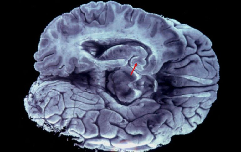 El proceso trata de generar conexiones entre las redes que conforman los 86 mil millones de neuronas que hay en el órgano. EL INFORMADOR / ARCHIVO