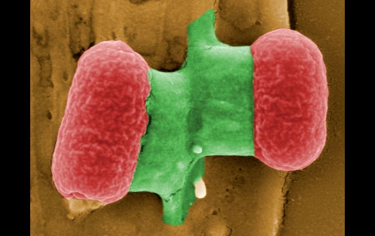 En la exposición se puede apreciar el tamaño de un virus en comparación con la punta de un alfiler. AFP / ARCHIVO