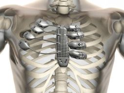 Se espera los hospitales empiecen a utilizar esta tecnología para la réplica y remplazamiento de huesos fracturados. EFE / ARCHIVO