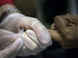 Datos de ONUSIDA indican que casi 14 millones de personas en todo el mundo están accediendo al tratamiento del VIH. AFP / ARCHIVO