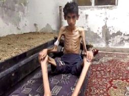 Habitantes de la ciudad sitiada de Madaya están muriendo por inanición por falta de asistencia humanitaria. AP /