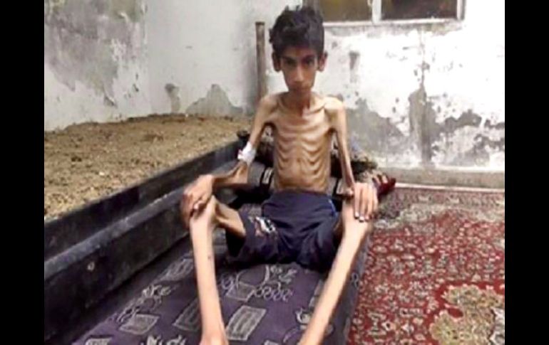 Habitantes de la ciudad sitiada de Madaya están muriendo por inanición por falta de asistencia humanitaria. AP /