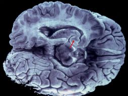 Es importante la función de la actividad eléctrica temprana en el cerebro. EFE / ARCHIVO