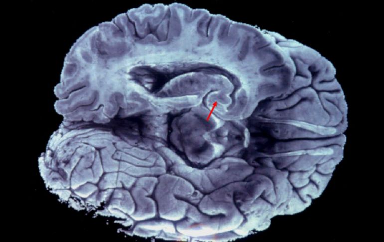 Es importante la función de la actividad eléctrica temprana en el cerebro. EFE / ARCHIVO