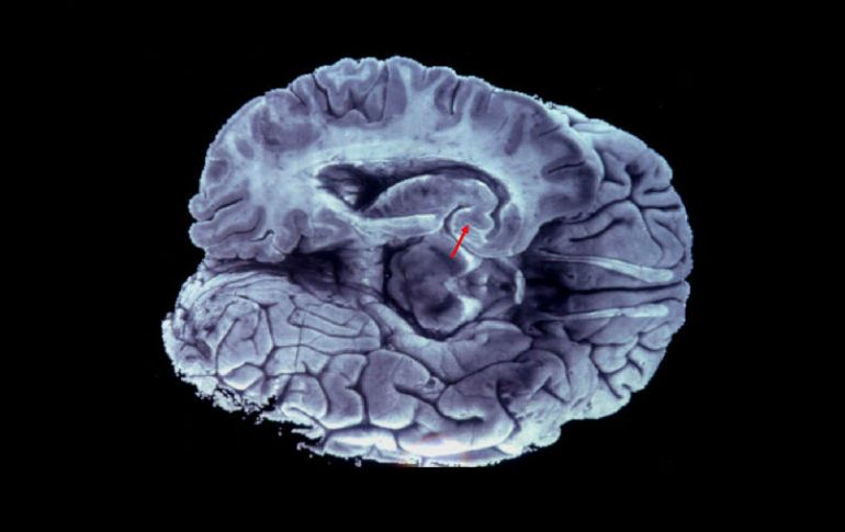 La geometría en el cerebro importa, pues al permitir que los pliegues se desarrollen en la adecuadamente se evitan enfermedades. EFE / ARCHIVO