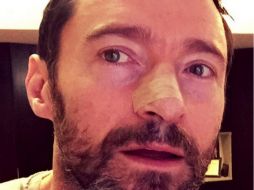 Jackman informó en redes sociales que nuevamente estaba siendo tratado y publicó una fotografía. TWITTER / @RealHughJackman