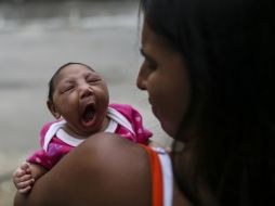 Los casos de microcefalia también han aumentado al mismo tiempo que las víctimas de zika. EFE / A. Lacerda