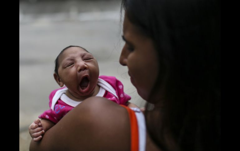 Los casos de microcefalia también han aumentado al mismo tiempo que las víctimas de zika. EFE / A. Lacerda