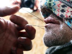 Nueve iraníes se muestran con la boca cosida y cosiéndola; el grupo está formado solamente por hombres. AP / M. Spingler