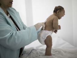 Buscan entender si hay otros efectos neurológicos en el desarrollo de los bebés. AP / ARCHIVO