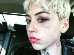 La artista dijo que fue golpeada en el rostro por un hombre que gritó 'Trump 2016'. INSTAGRAM / @illmagore