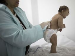 El zika puede causar severos defectos congénitos, como el nacimiento de bebés con cabezas anormalmente pequeñas. AP / ARCHIVO