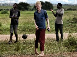 Los albinos en varios países de África viven aterrorizados, y cada vez más niños se ven obligados a dejar la escuela. AFP / ARCHIVO