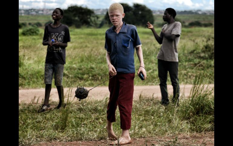 Los albinos en varios países de África viven aterrorizados, y cada vez más niños se ven obligados a dejar la escuela. AFP / ARCHIVO