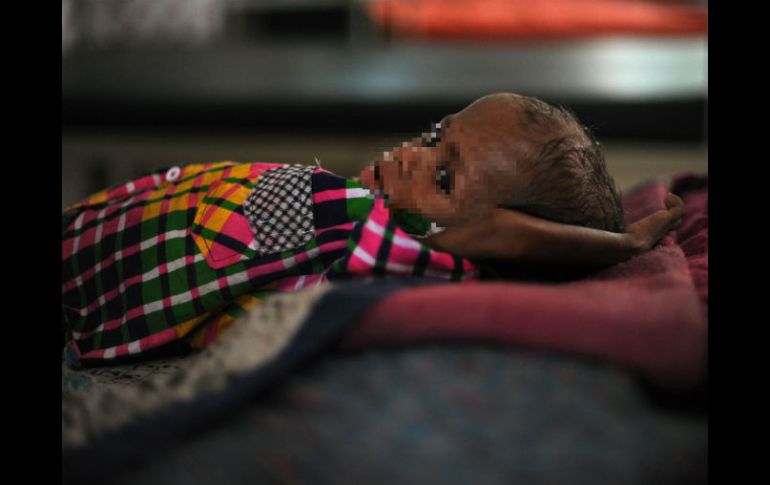 Denuncian que en Banki uno de cada tres niños menores de cinco años sufren malnutrición. AFP / M. Sharma