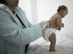 Más de mil 800 casos de zika han sido reportados en Estados Unidos, según datos federales. AP / ARCHIVO