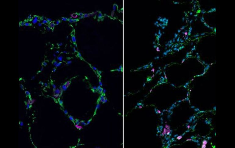 El tejido se obtuvo recubriendo diminutas partículas de hidrogel con células madre procedentes de pulmones. ESPECIAL /